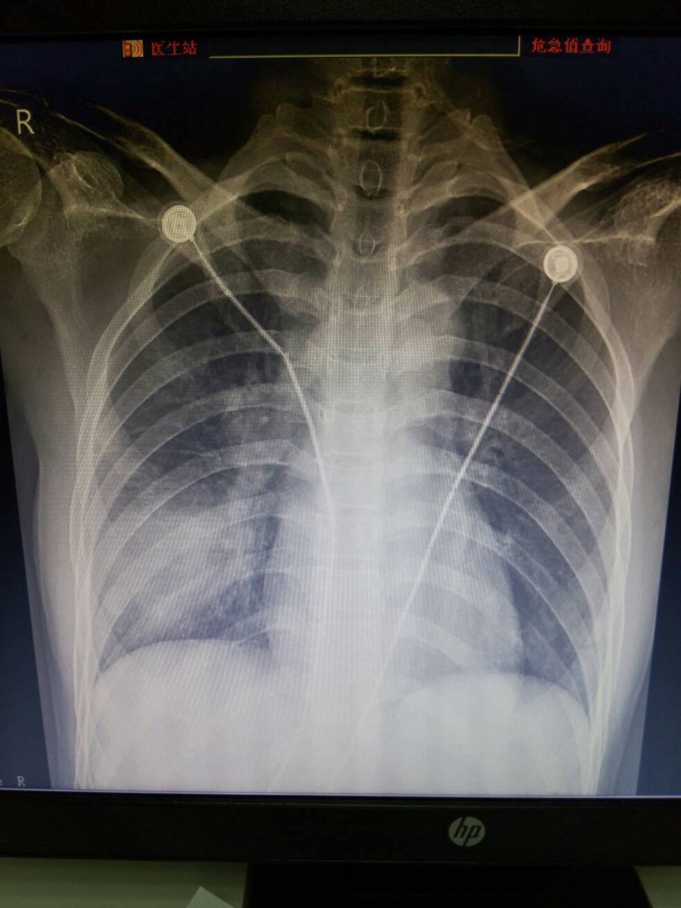 病例图片
