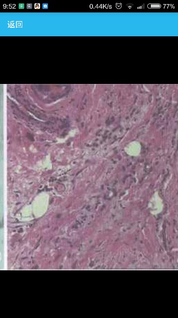 病例图片