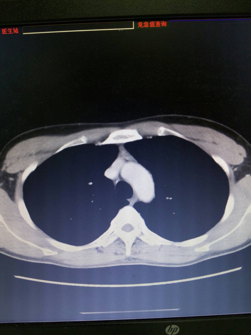 病例图片