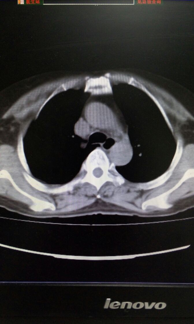 病例图片