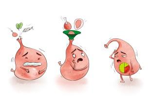 医学动画：消化性溃疡(胃)