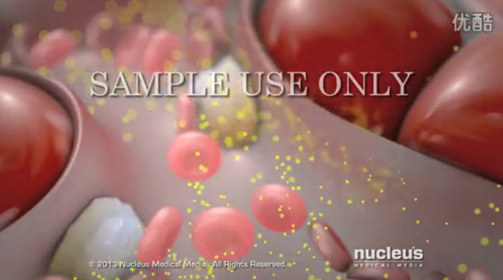 医学动画：丙型肝炎