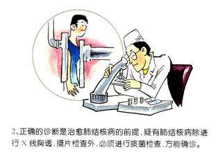 [教育]肺结核的诊断与治疗