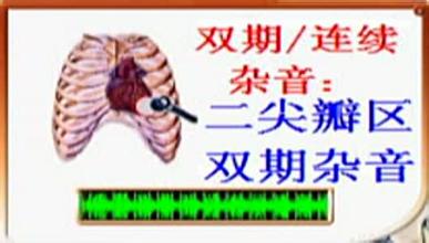 [教育]心肺听诊