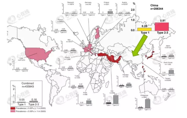 遗传性心律失常—Brugada综合征概述