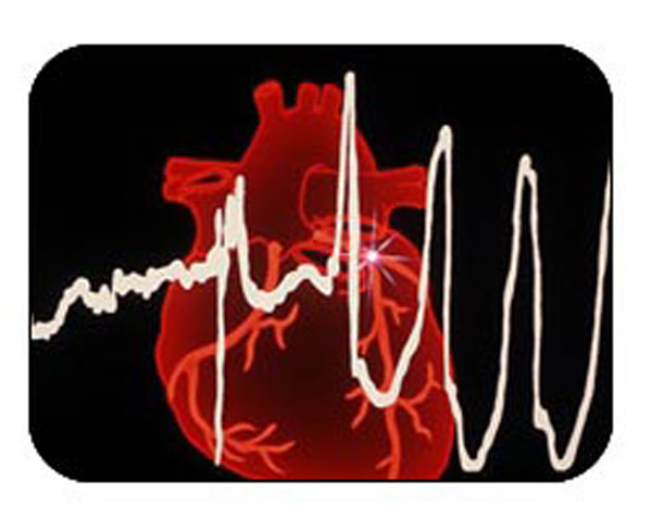 急性胸痛诊治，思路步骤