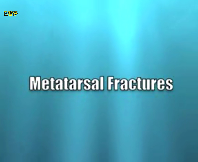 跖骨骨折