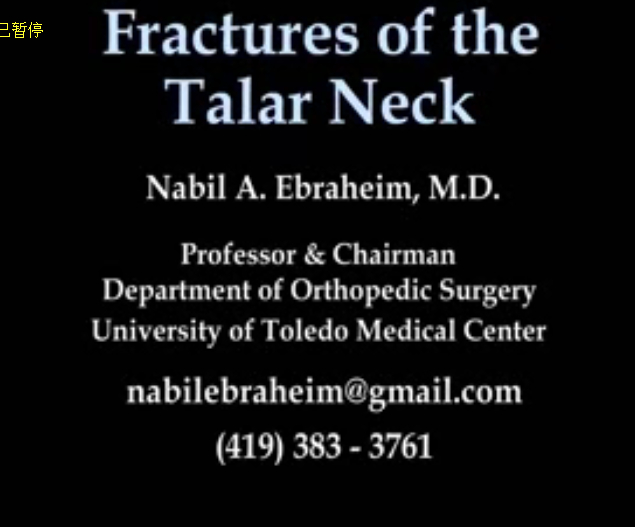 距骨骨折， Hawkin分类