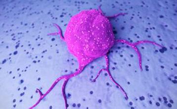 神经内分泌瘤是怎么回事？